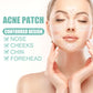 Spotless Shield: Acne Defense Surface Patch